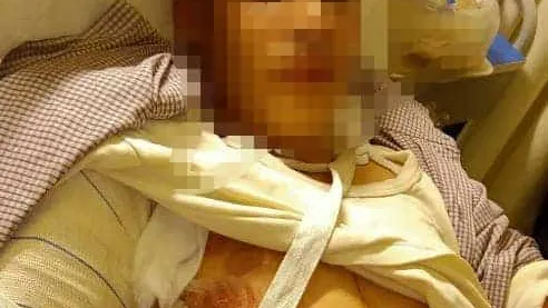 عامل يناشد وزير القوى العاملة باستعادة حقوقه.. سقطت فى بريمة مطحن الماسة وأصبت بعجز كلى بذراعى والشركة لم تسأل عنى