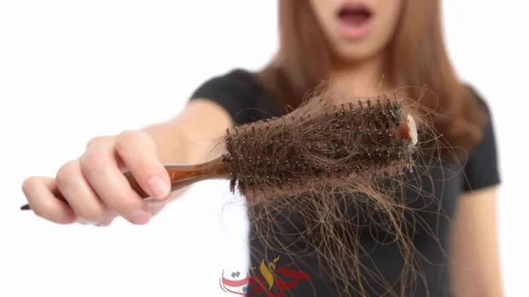 من الأعراض الجديدة لكورونا تساقط الشعر .. إعرف التفاصيل