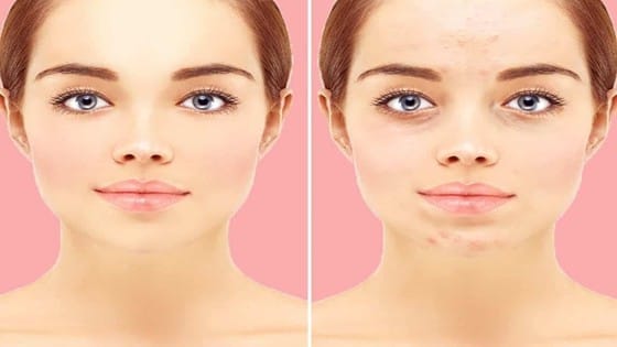 للحفاظ على بشرتك من الدهون فى الصيف .. اتبعى هذه النصائح