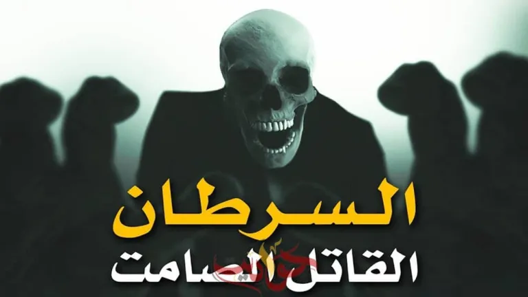 هذه العلامة في الجسم تكشف إصابتك بمرض السرطان