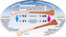 هشاشة العظام يصيب أكثر من 200 مليون انسان بالعالم