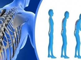 هشاشة العظام