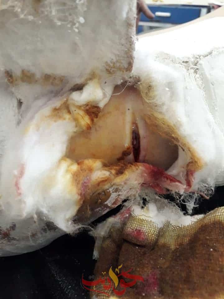 صورة للجرح القطعى