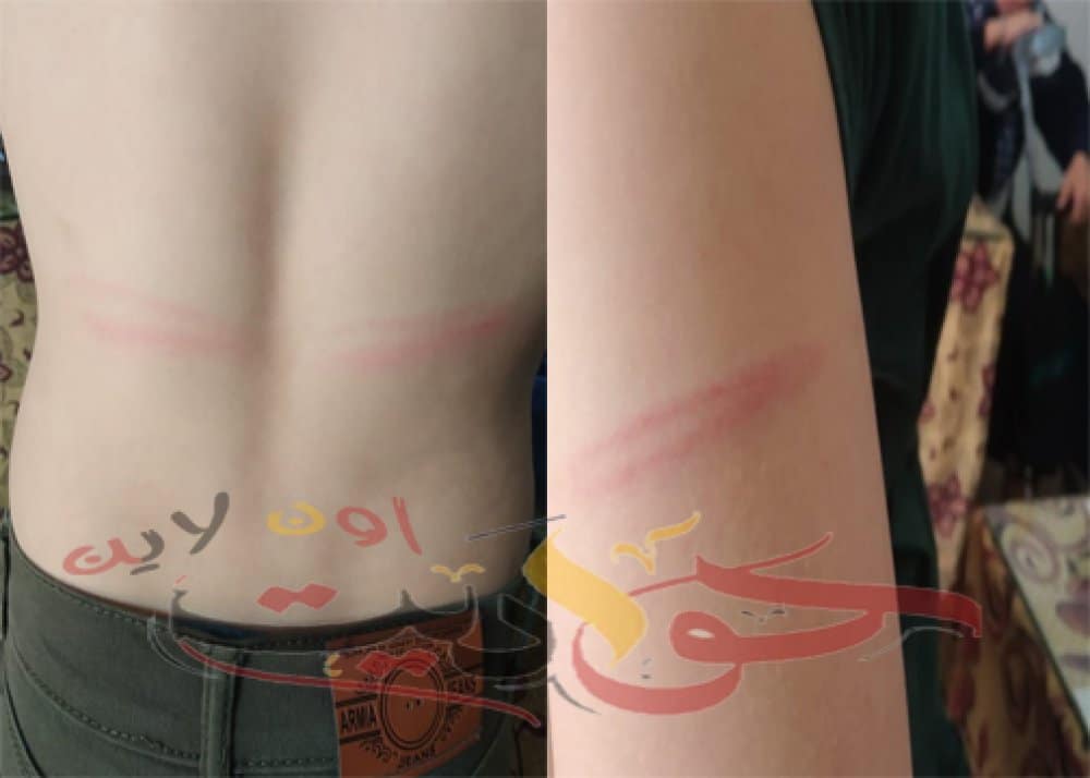 مُدرسة تضرب طالب لديها ضرب مبرح بأبو رجوان البحرى الأعدادية .. والسبب صادم