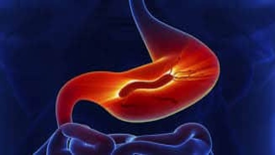 استشاري تغذية: الصيام المتقطع لأسبوع يقلل حجم المعدة ويجدد خلايا الجسم