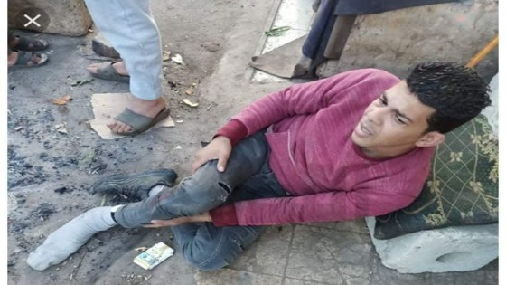 إصابة شاب صدمه قطار أثناء عبور شريط السكة الحديد بالبدرشين