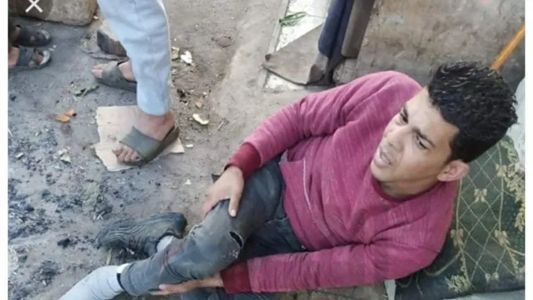إصابة شاب صدمه قطار أثناء عبور شريط السكة الحديد بالبدرشين