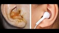انت مجرم فى حق نفسك .. استشاري أنف وأذن وحنجرة يحذر من ارتداء سماعات الأذن