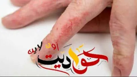 السيدات احذروا من مرض "ست البيت" مرض خطير .. تعرفى على اسبابه
