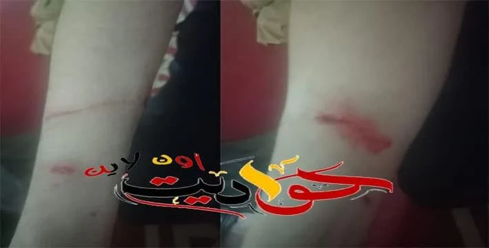 كلاب ضاله