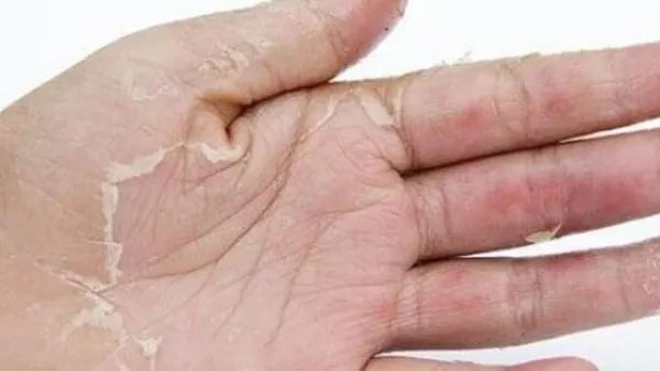 استشر الطبيب في هذه الحالة فوراً
