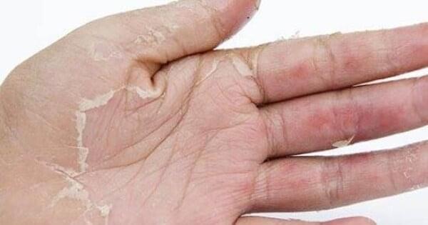 استشر الطبيب في هذه الحالة فوراً