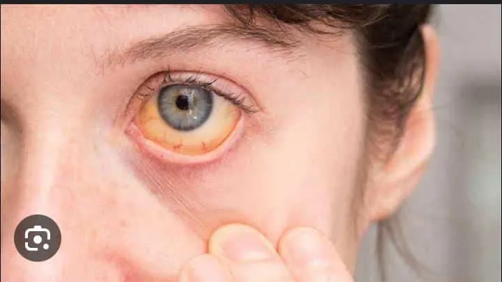 طبيب أطفال للآمهات خالى بالكم من اولادكم .. يحذر من هذا المرض