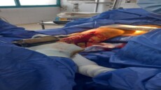 من الموت إلى الحركة .. عملية بطولية بمستشفى البدرشين تُدهش الجميع!