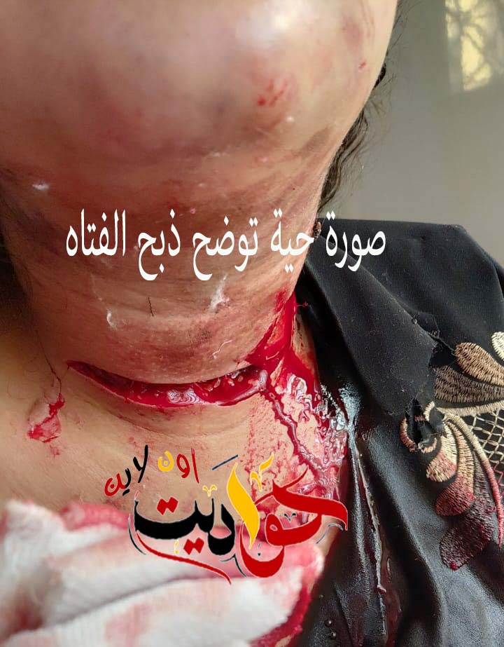 «بيديه أعاد الحياة من الموت» .. مدير مستشفى البدرشين يصنع معجزة طبية بعد ذبح فتاة حملت سفاحًا! .. شاهد الصور 2 «بيديه أعاد الحياة من الموت» .. مدير مستشفى البدرشين يصنع معجزة طبية بعد ذبح فتاة حملت سفاحًا! .. شاهد الصور